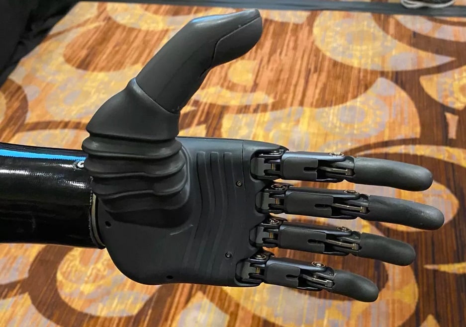 Protezy ze sztuczną inteligencją