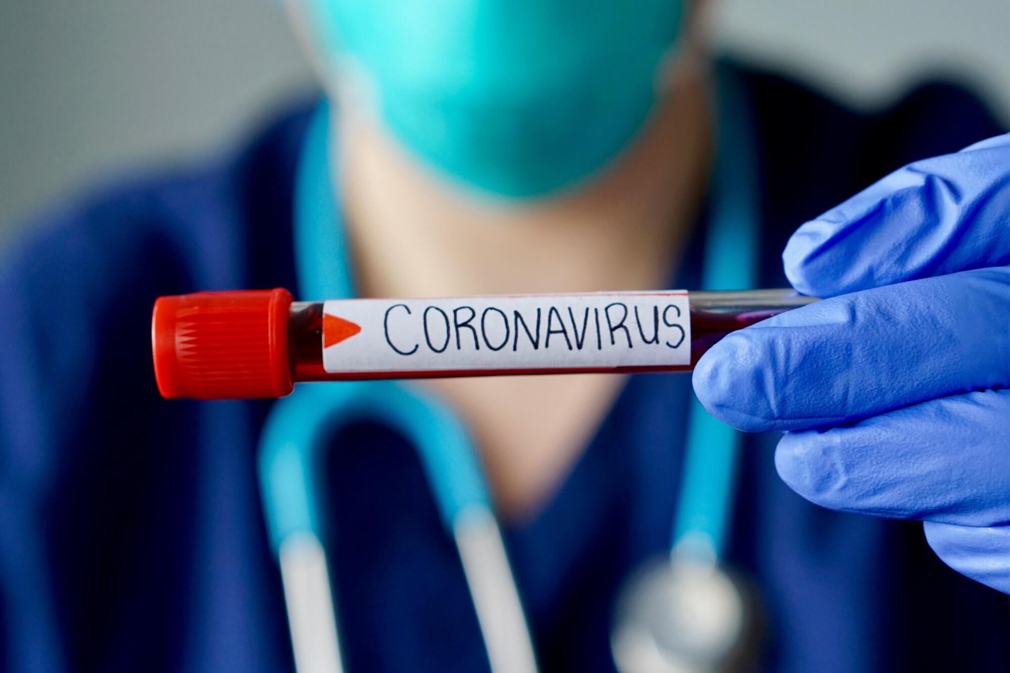 Firmy technologiczne walczą z fakenewsami o koronawirusie