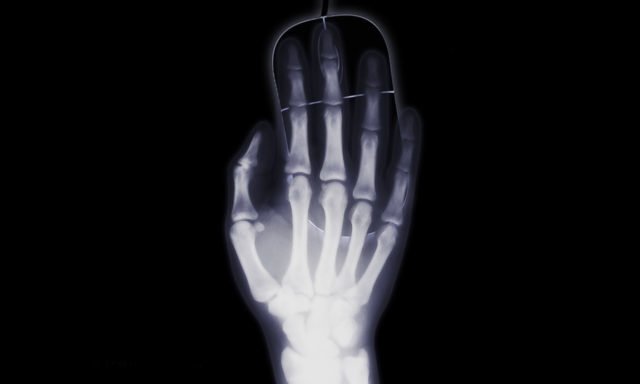 Radiografia, zdjęcie. Prześwietlenie dłoni w pozycji z uniesionymi palcami na czarnym tle.