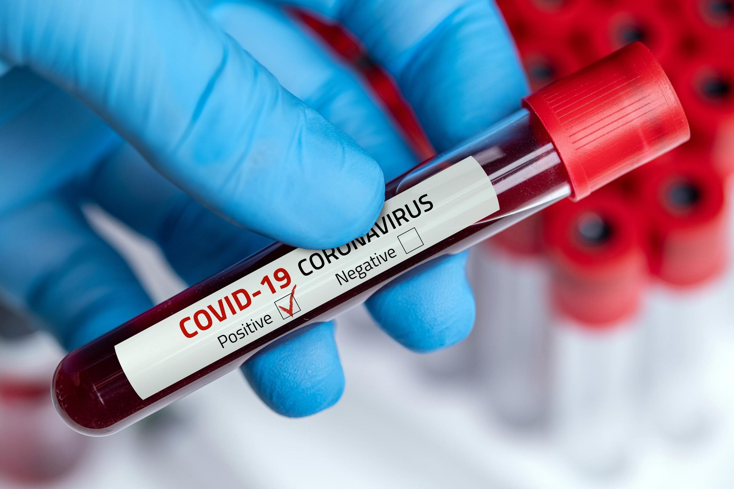 Mirosoft szczepionka COVID-19 bezpieczeństwo