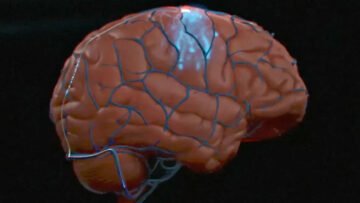 Synchron połączył mózg z komputerem