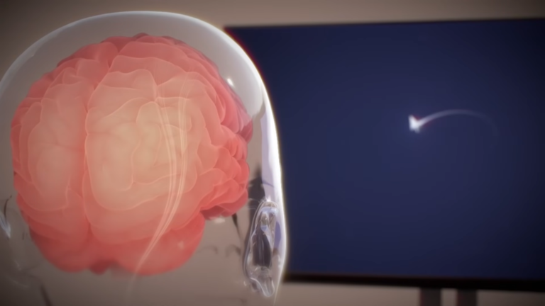 Model mózgu w przezroczystej głowie na tle ciemnoniebieskiego ekranu z białą, zakrzywioną strzałką wskazującą prawidłową drogę impulsu nerwowego. Prezentacja projektu Neuralink