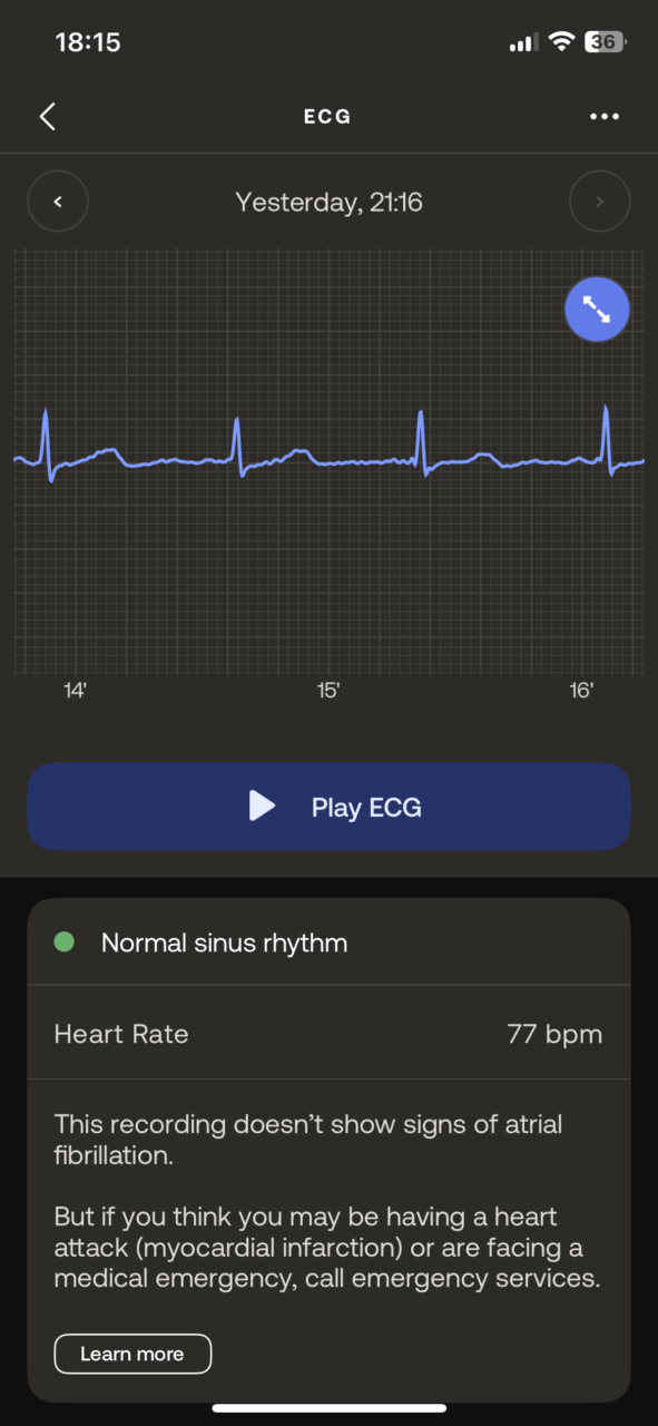 Zrzut ekranu z aplikacji mobilnej przedstawiający elektrokardiogram (EKG) z normalnym rytmem zatokowym i częstością pracy serca 77 uderzeń na minutę. Wyświetlacz wskazuje, że nagranie nie wykazuje oznak migotania przedsionków i zawiera przycisk odtwarzania EKG oraz dodatkowe informacje dotyczące zdrowia serca.