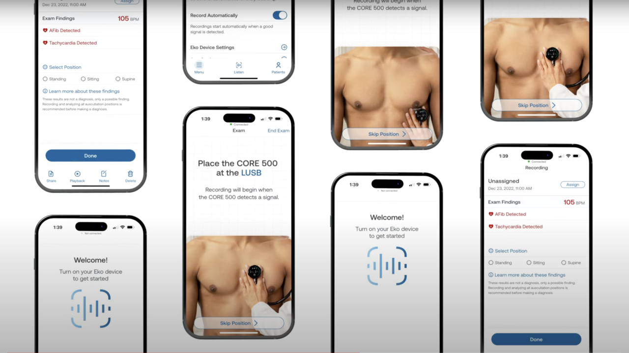 Zestaw zdjęć przedstawiających smartfony z aplikacją Eko Sensora do monitorowania zdrowia oraz instrukcje użycia urządzenia medycznego do słuchania serca.